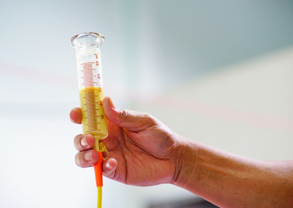 What to Expect when Using a Feeding Tube with Your Child